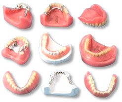 tipuri proteza dentara